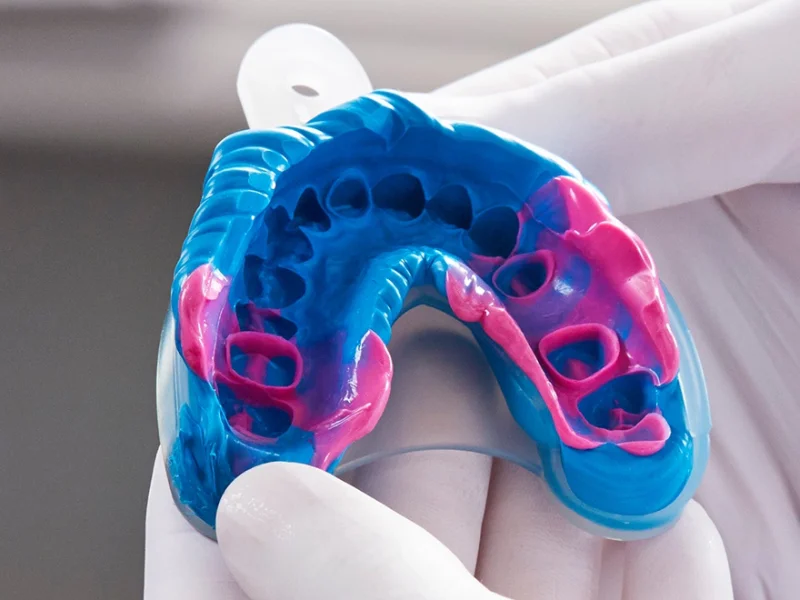 Paso 1 - Toma de impresiones dentales